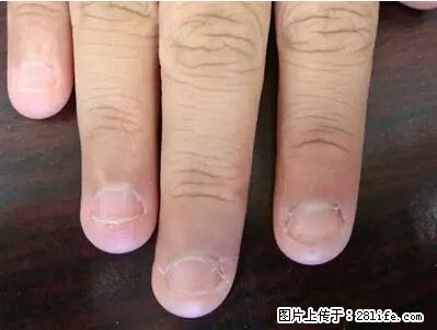 剪指甲、挖耳屎，这些日常小动作竟隐藏大危害！ - 鹤壁生活资讯 - 鹤壁28生活网 hb.28life.net
